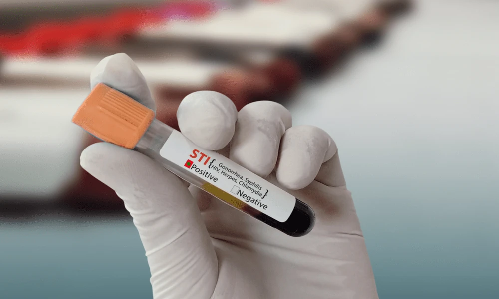 Why Routine STI Testing Matters Even Without Symptoms in Orlando